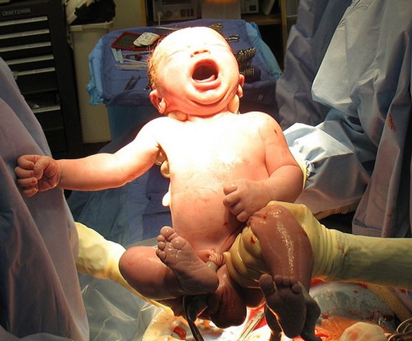 A newborn baby, being held up "in-theatre" following a c-section